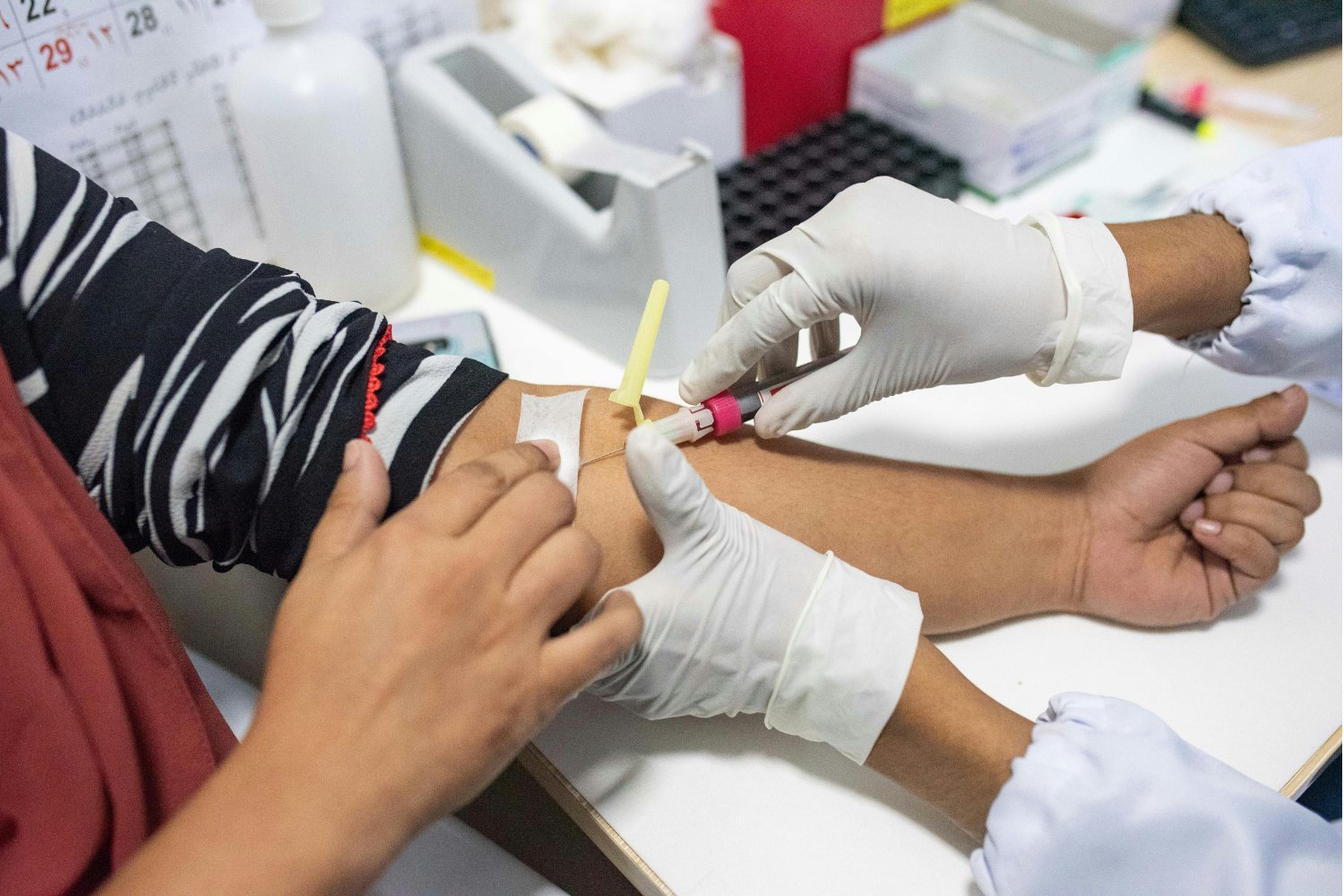 Paprastas testas, galintis pakeisti Alzheimerio ligos likimą