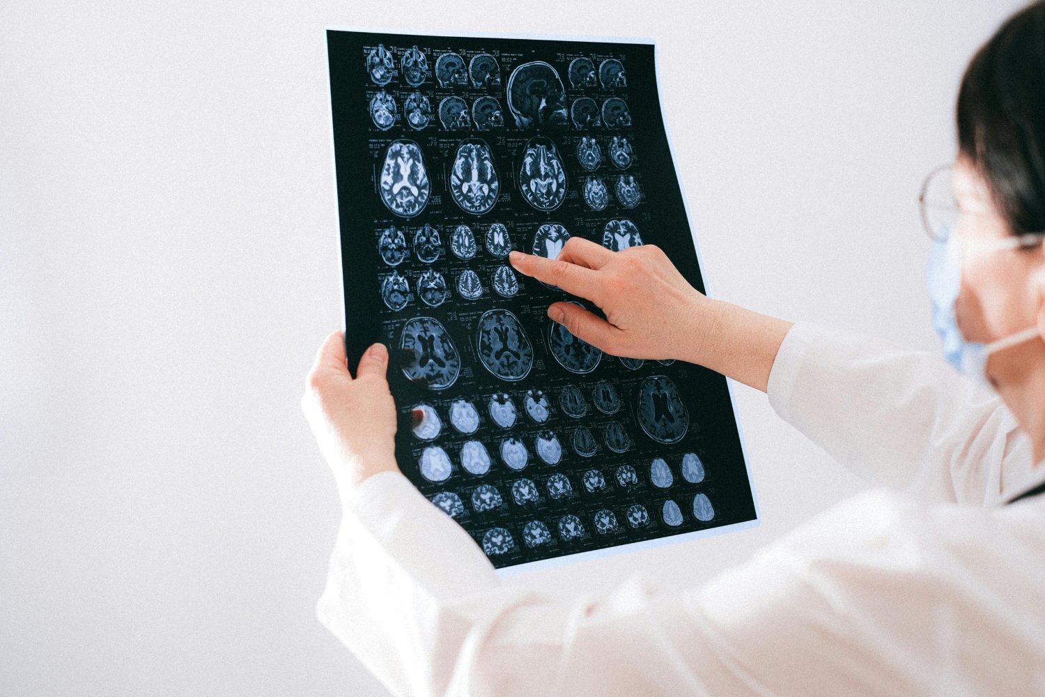 Naujas žvilgsnis į sužeistas smegenis: metodas, galintis pakeisti traumines diagnozes